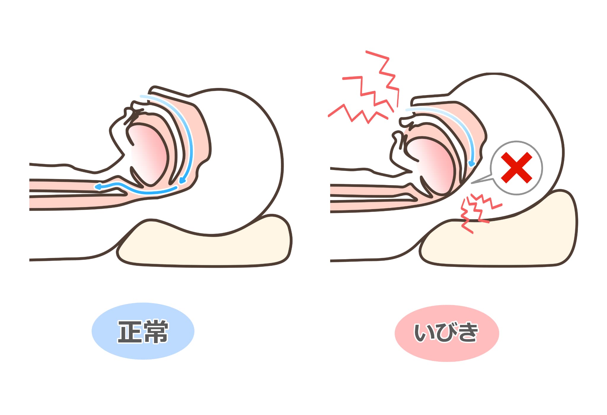 正常な呼吸といびきの比較