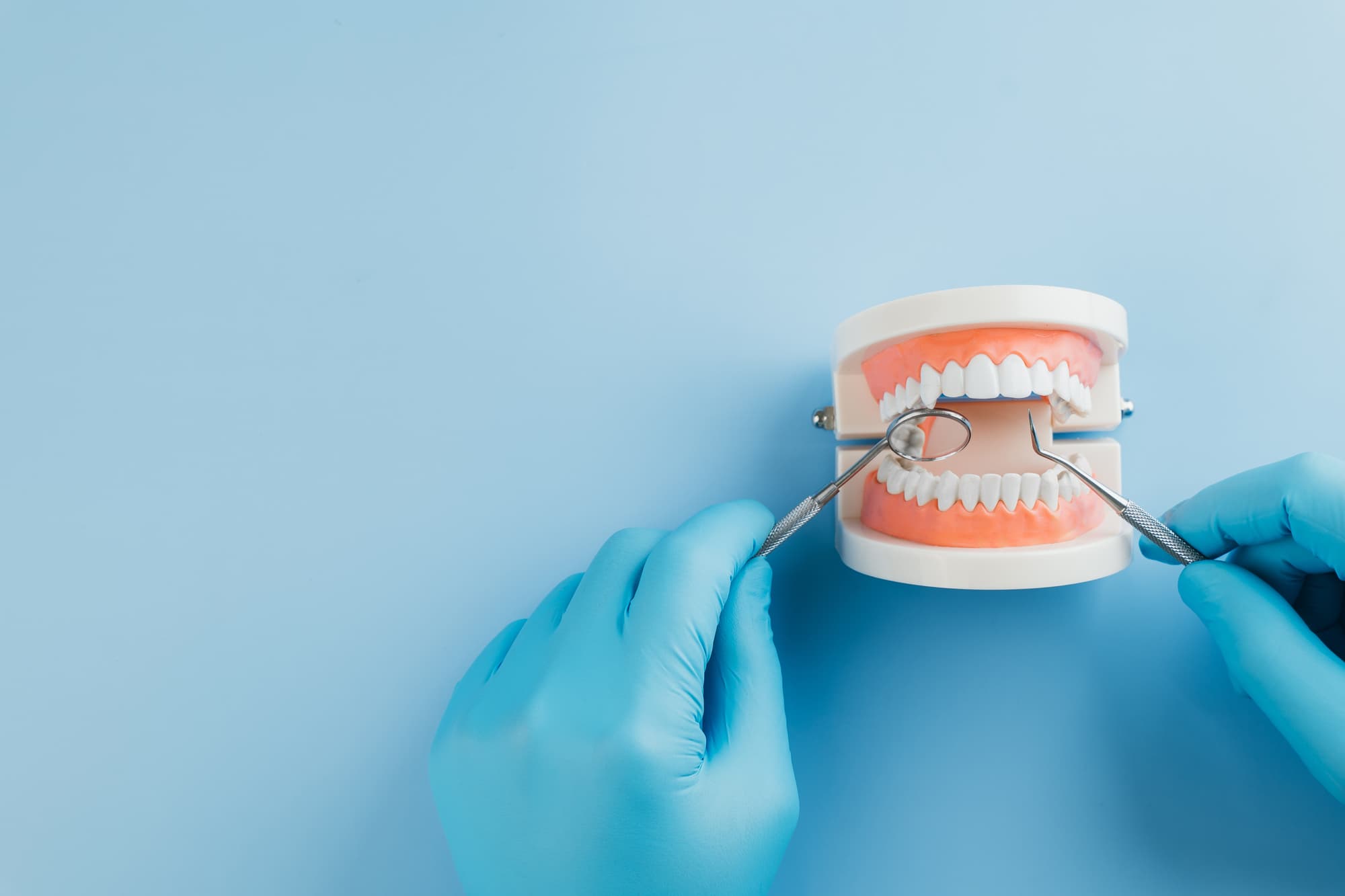 口腔チェックのイメージ