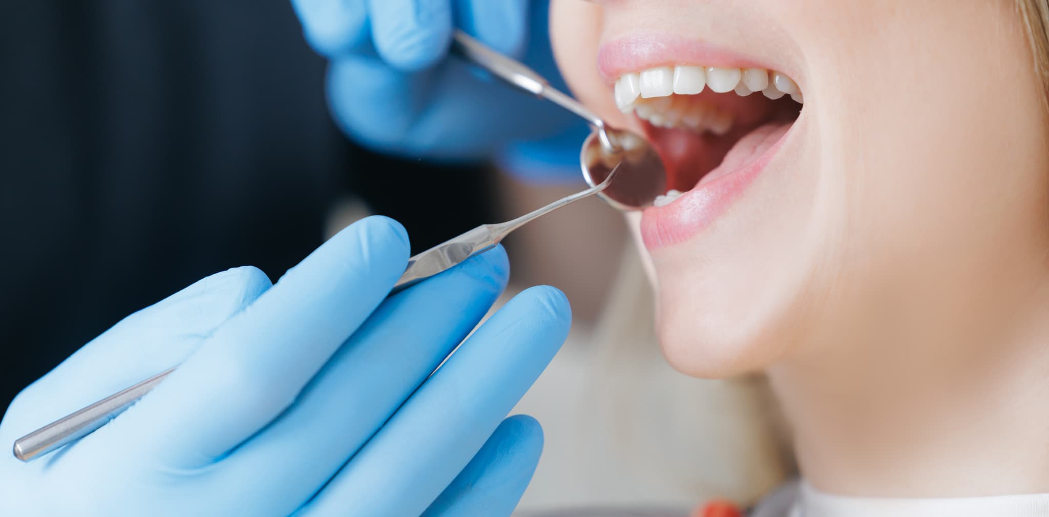 歯科医院でお口のメンテナンスをする様子